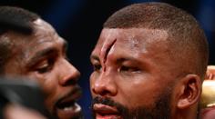 Jatka v ringu! Boxer soupeři otevřel hlavu a jizva teď děsí svět