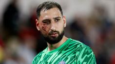 Deset stehů a nucená pauza. Hvězda PSG kurýruje děsivé zranění ze šlágru
