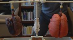 Rakovina plic na vzestupu: Jaké jsou její příznaky?