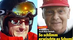 NECHUTNÉ! Tropí si ze Schumiho šprýmy? Prý teď vypadá stejně špatně jako Niki Lauda
