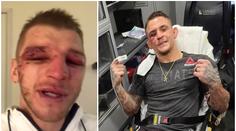 Poirier s Hookerem stanovili nový UFC rekord! Takhle dopadli po zápase