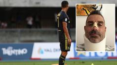 První zářez CR7 v Serii A: Gólman v bezvědomí se zlomeným nosem!