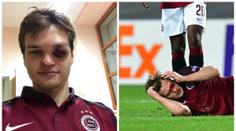 HOROR na Spartě: Pulkrabovo oko zmizelo v krvi! Co řekli lékaři?