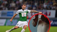 Vít Beneš může hrát i bez ledviny! V Maďarsku dostal povolení