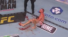Klein dostal za heroický výkon v UFC finanční bonus! Popsal vážnost zlomeného kotníku