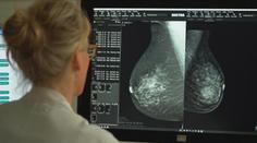 Mamograf snižuje úmrtnost na rakovinu o třetinu. Některé ženy ale vyšetření ignorují
