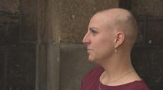 Lidí s alopecií přibývá. Na léčbu pojišťovny moc nepřispívají