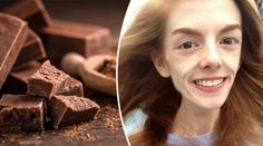 Velká proměna! Dívka vážila 29 kilo. Život jí zachránila čokoláda