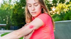 První pomoc při bodnutí hmyzem? Propiska vám zachrání život, radí lékař