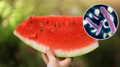 Hygienici varují: Melouny mohou způsobit i úplavici, na tohle pozor!