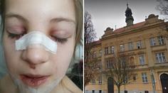 Pád dívky (8) ve škole vyšetřuje policie! Podle matky mohla zemřít