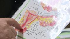 Rakovina děložního čípku zabije stovky žen ročně. Důležitá je prevence a očkování