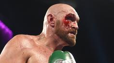 Fury krvácel, přesto zápas vyhrál. Pak musel do nemocnice na šití