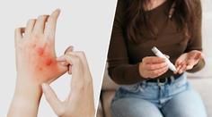 Cukrovku můžete odhalit podle své kůže. Těchto sedm signálů nikdy nepodceňujte
