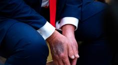 Záběry Trumpa vyvolaly divoké spekulace o jeho zdraví. Bílý dům má bizarní vysvětlení