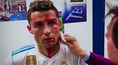 Ronaldovo krvavé zranění zblízka: Tohle dělal lékař v kabině! VIDEO