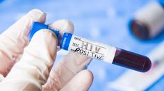 Experti odhalili nakažlivější variantu HIV. Šířila se už v 80. letech