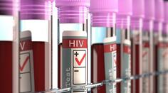 Vědci hlásí průlom v léčbě HIV. Máme "vypínač" viru, tvrdí!