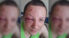 Napomenul dítě na dětském hřišti. Takhle ho zřídili jeho rodiče