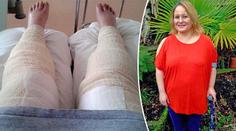 Oholila se a skončila v kómatu! Dana téměř přišla o nohy i život