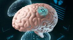 Revoluční implantát: Pomáhá ochrnutým pacientům k návratu do života