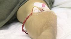 V Česku se rychle šíří žloutenka typu A. Hygienici radí, kde si na ni dávat pozor