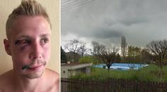 Je to jinak, tvrdí svědkyně o bitce v Dubí: Není to hrdina, praštil ženu