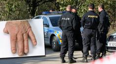 ZÁHADA NA KLADNĚ: Našel se kus prstu, policie hledá majitele