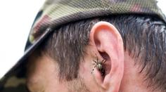 V ženině uchu žil pavouk. Nejde o ojedinělý případ, varují lékaři