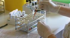 V Česku roste počet nakažených žloutenkou. Hygienici zavádějí opatření