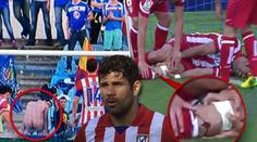 VIDEO: Holý zadek, zahozená penalta a tržná rána na holeni! Costa byl u všeho