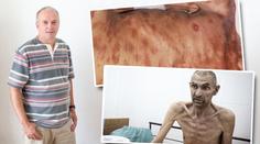 Pravá tvář AIDS: Muž promluvil o utrpení umírajících! SVĚDECTVÍ