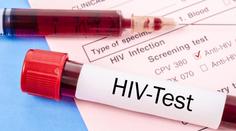 V části Evropy roste počet případů HIV. Výskyt viru eviduje i Česko