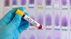 Na severu Čech propukla epidemie žloutenky! Tohle jsou její příznaky
