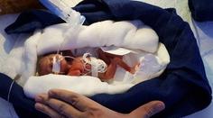 Novorozenec vážil jen 400 gramů, ale přežil! Slova lékaře dojala svět