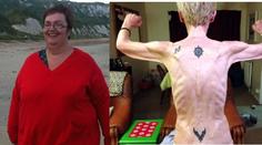 Brutální proměna: Z obří koule je anorektická vyzáblina s 35 kilo!