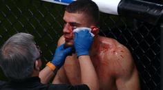 Jen pro otrlé! UFC fighter málem přišel o ucho, rozhodčí musel zápas zastavit