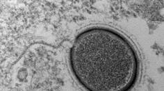 Vědci chtějí oživit obří virus ze Sibiře. Je starý 30 tisíc let!