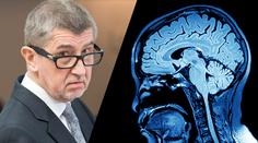 Nemoci Babišových dětí přináší myšlenky na smrt, říká psychiatr
