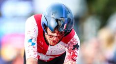 Cyklista i přes děsivou nehodu dojel do cíle. Utrpěl otřes mozku a zlomeniny