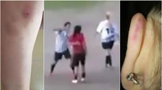 Za faul se pomstila tvrdým loktem! Fotbalistka zůstala ležet VIDEO