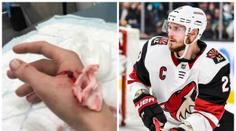 Stehy a tetanus! Hvězdného obránce NHL pokousal jeho vlastní pes