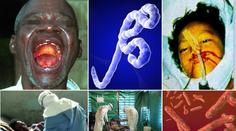Vše o viru EBOLA: Kde se vzala a jaké má PŘÍZNAKY?