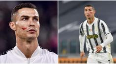 Tajemství červené skvrny na tváři Ronalda? Je to kampaň!