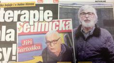 Bartoškův boj s rakovinou: Zatím nezvládne hrát ani v paruce!