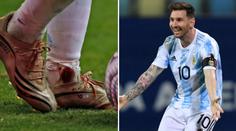 Válečník Messi: Nezastavilo ho šest faulů za žlutou kartu ani krvavý kotník