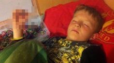 Gumičková závislost: Školák (8) málem přišel o prsty! Foto uvnitř