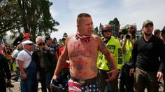 Modřiny, krev a mléko: V Berkeley se kvůli Trumpovi popralo 200 lidí