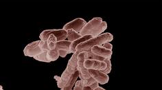 HYGIENIK RADÍ: Jak se bránit nebezpečné bakterii E.coli