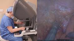 Lékaři operují častěji pomocí robotů. Důvodem je přesnost zákroků